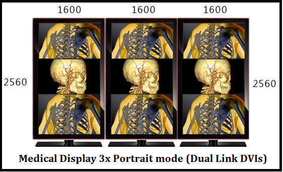 Dual link DVI