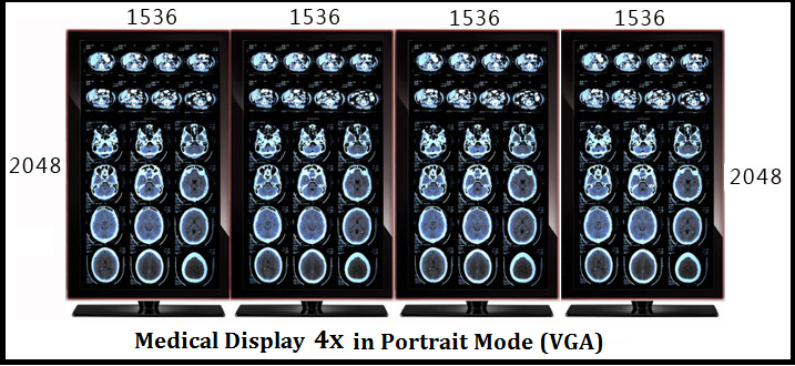 Medical Displaying